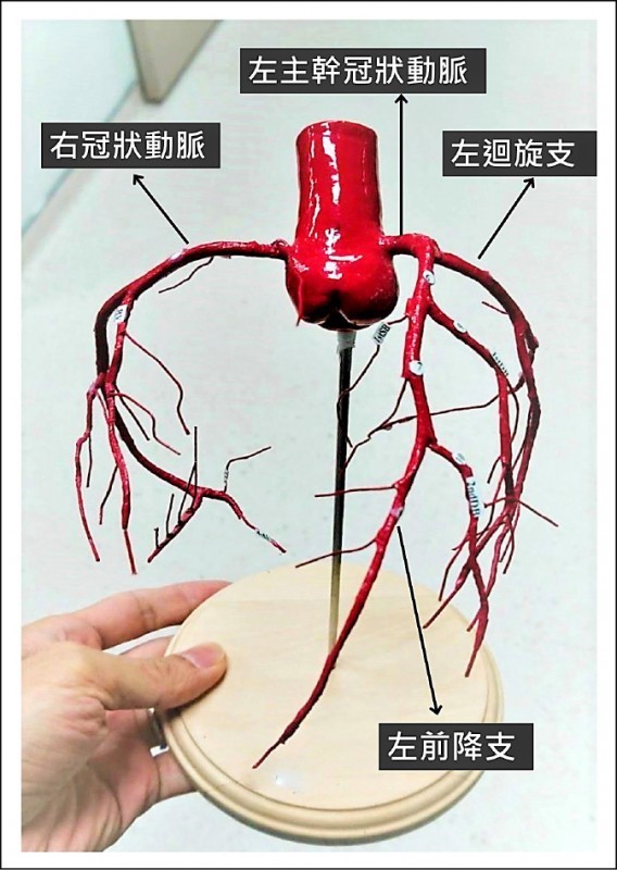 心脏主要由3条冠状动脉供应氧气与养分