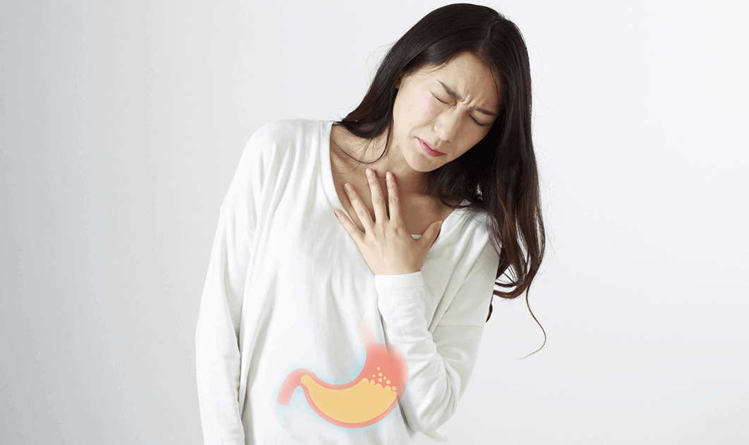 胃灼热、食道逆流 胃灼热、食道逆流