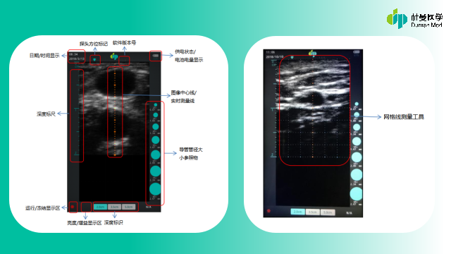 20190527170447_88951.png 5e1074995f.png