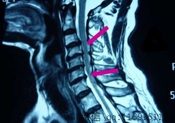 20180310205150_72773.jpg sb13_看图王.jpg