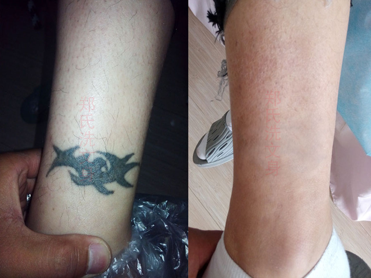 洗文身的效果通常是比较好但具体效果会受到多种因素的影响